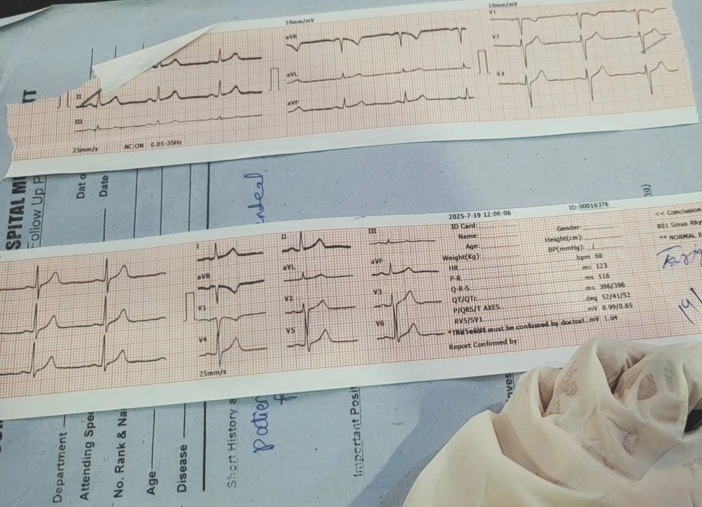 EKG și Monitorizare Cardiacă la domiciliu București